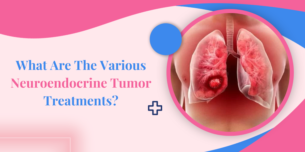 What Are The Various Neuroendocrine Tumor Treatments?