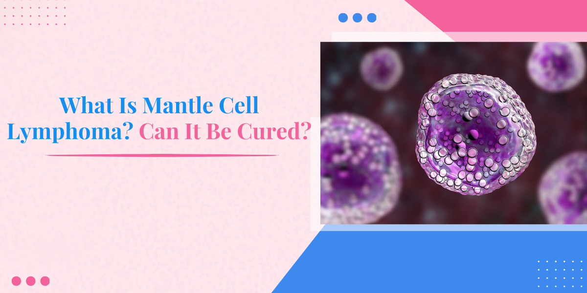 What Is Mantle Cell Lymphoma? Can It Be Cured?